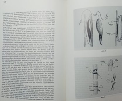 Wundheilung, Nahttechnik und Nahtmaterial [Bericht über ein Symposium in Bad Dürrheim Band 1/1977]. 3